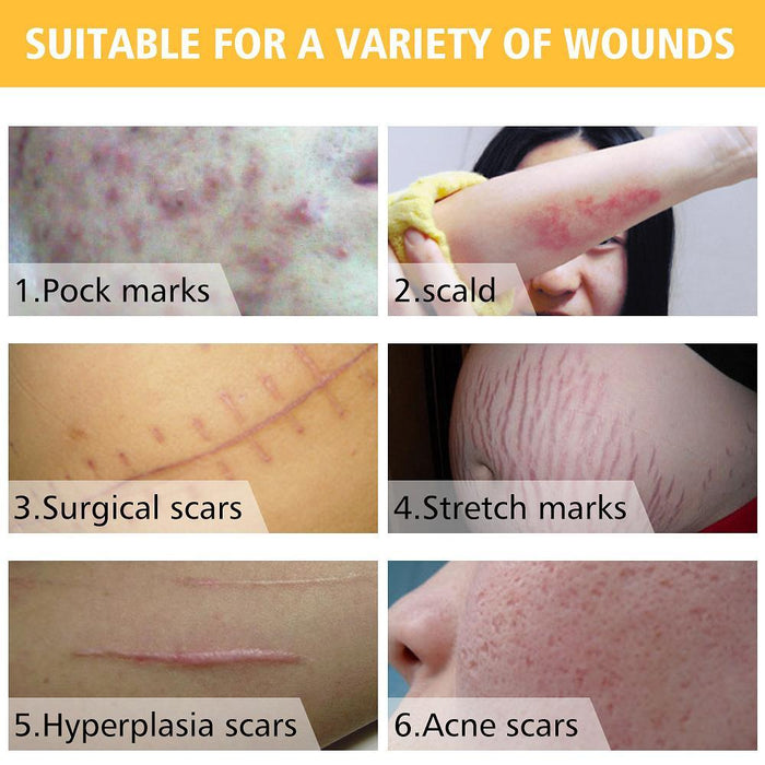 '- (3PK) Scar Remover Cream